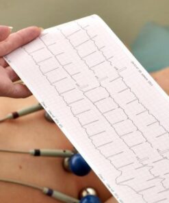 ECG